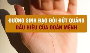 ban-tay-co-duong-sinh-dao-doi-dut-quang